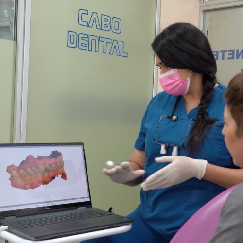 Escaner Intraoral_Cabo Dental_Bruente